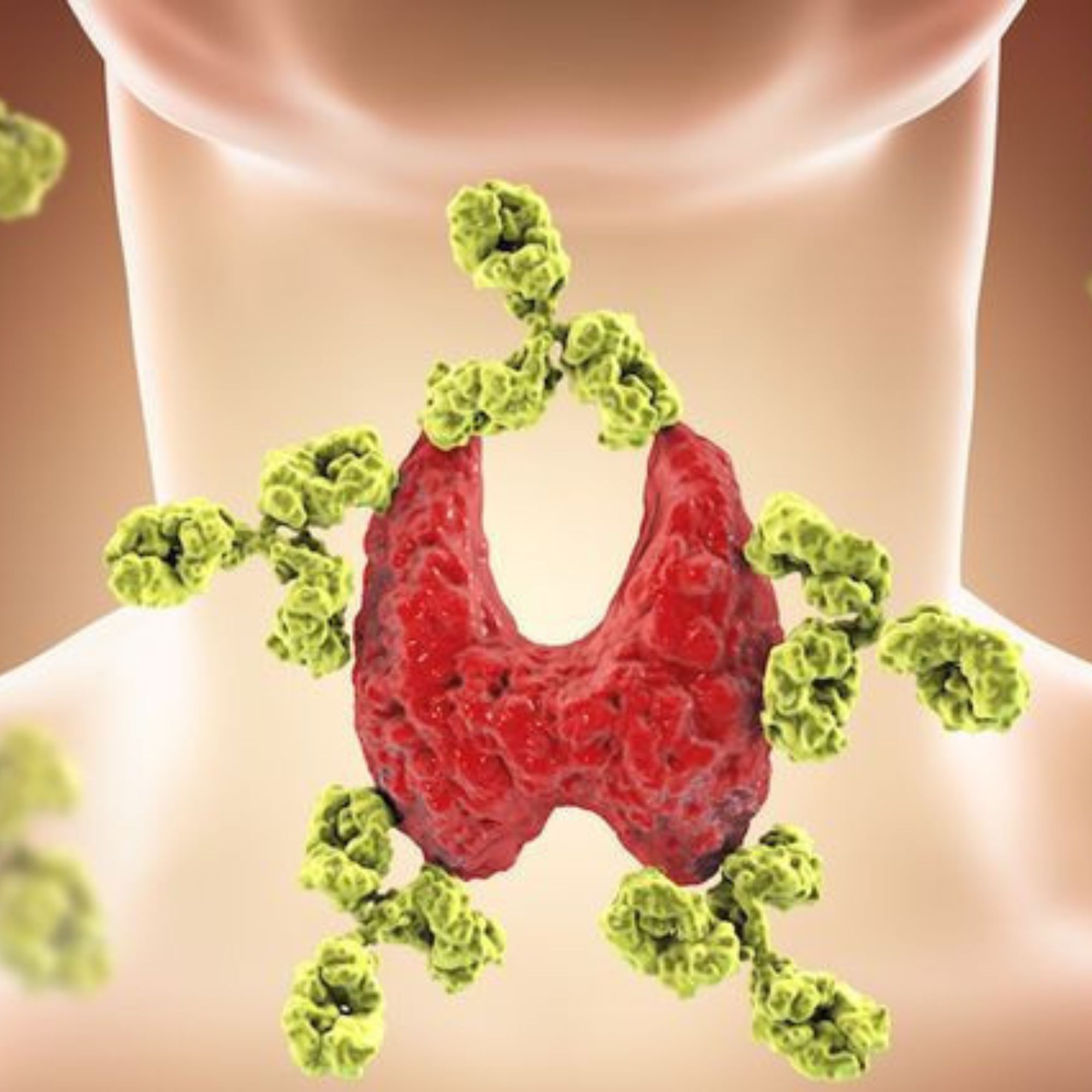 Haşimoto xəstələri necə qidalanmalıdır?